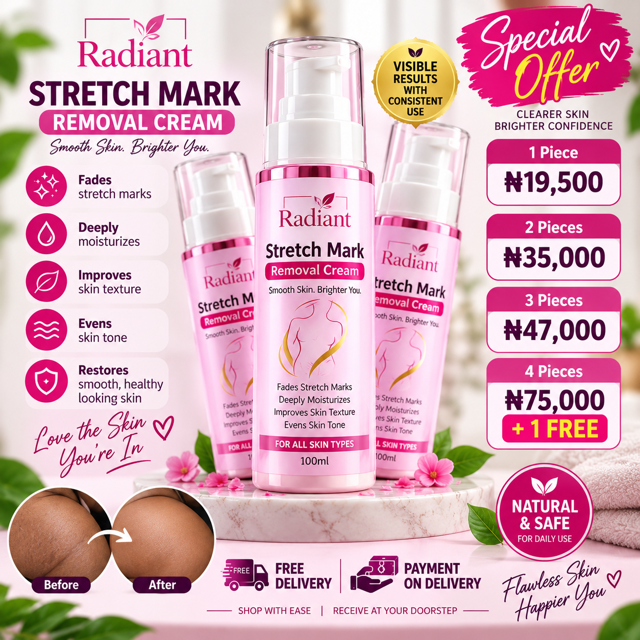 Radiant Stretch Mark Removal Cream packages and prices: 1 piece 19,500 naira, 2 pieces 35,000, 3 pieces 47,000, 4 plus 1 free 75,000