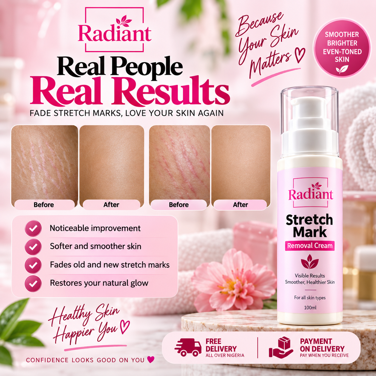 Before and after results from real customers using Radiant Stretch Mark Removal Cream