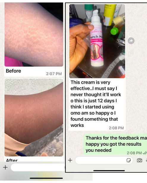 Customer chat messages sharing positive results with Radiant cream